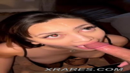 Cumming on her braces