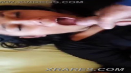 Mocos en la cara